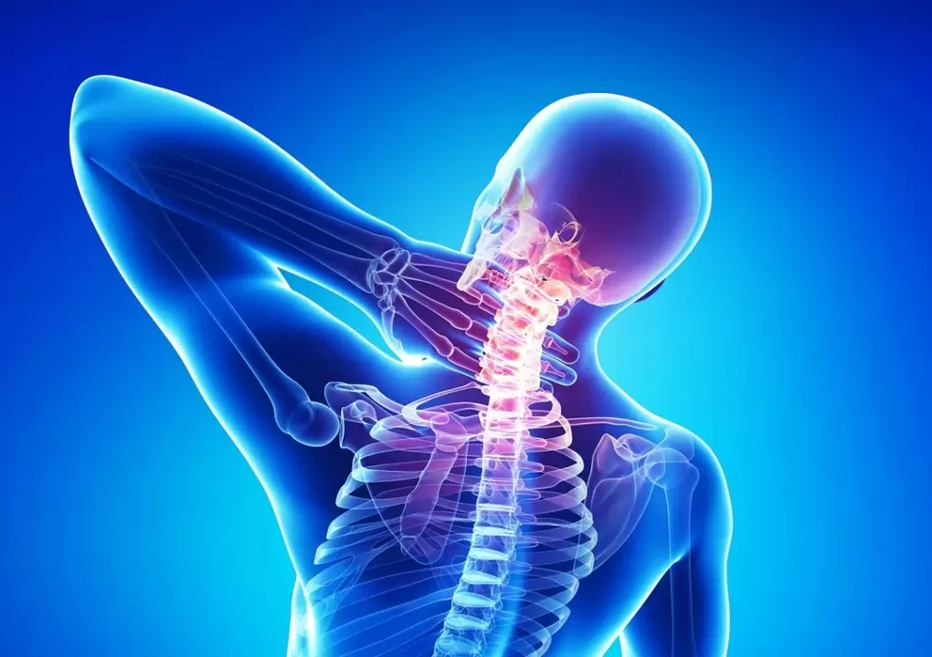 L'osteocondrosi è una malattia della colonna vertebrale