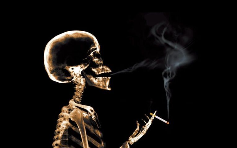 Il fumo come causa di mal di schiena nella zona della scapola