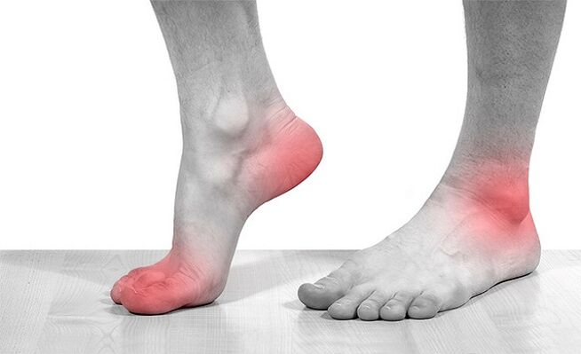 Dolore alle articolazioni della caviglia con artrosi