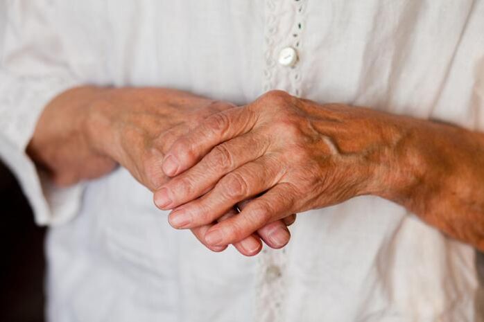 Il dolore alle articolazioni delle mani spesso disturba le persone anziane