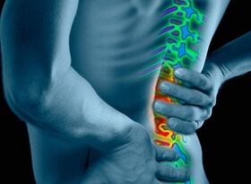 Cause e sintomi dell'osteocondosi
