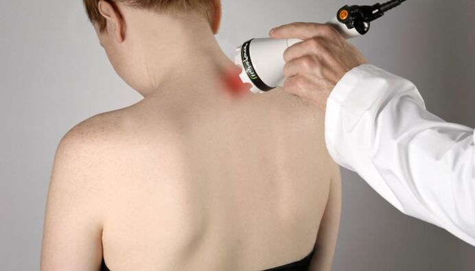 Laserterapia per l'osteocondrosi cervicale
